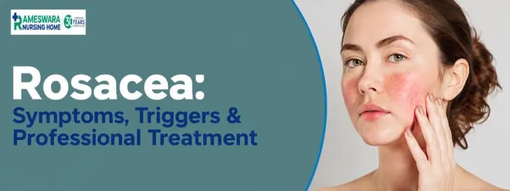 Rosacea: Symptoms, Triggers & Professional Treatment